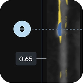 UI view 2