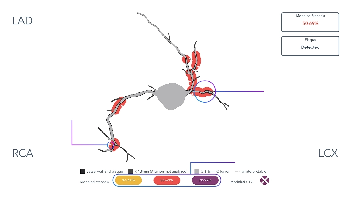 How Heartflow Roadmap Works diagram