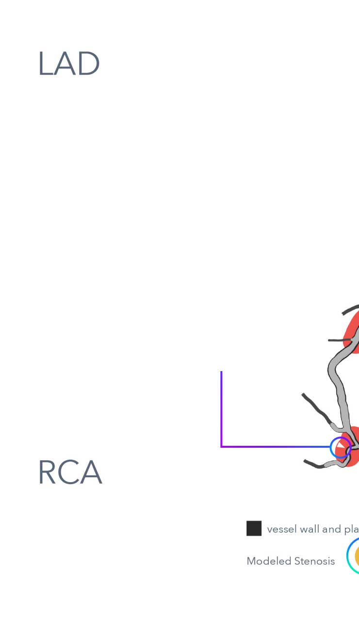 How Heartflow Roadmap Works diagram
