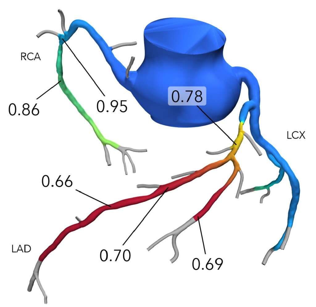 ffrct page spider image