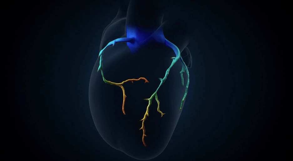ffrctproductexplainer video