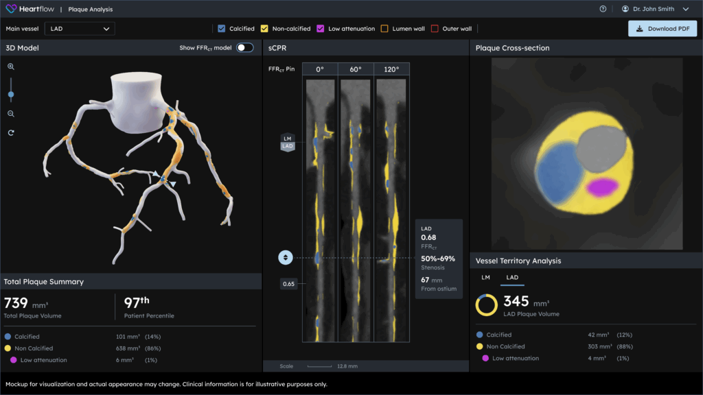 nextgenplaque marketing ui