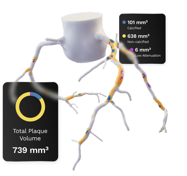 total plaque volume img 1
