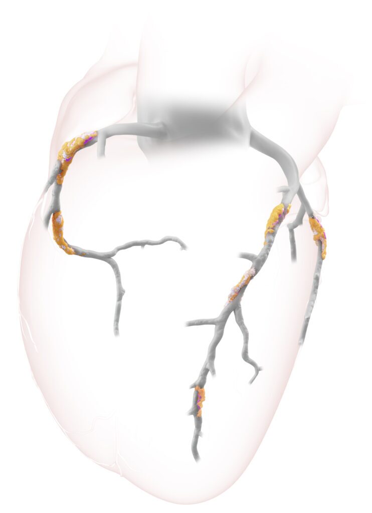 heart game one