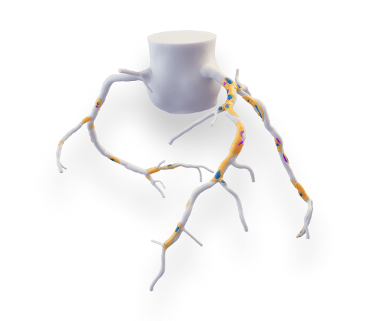card img plaqueanalysis