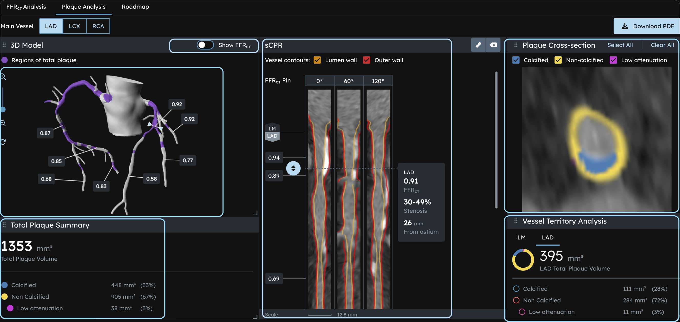 screenshot of plaque analysis