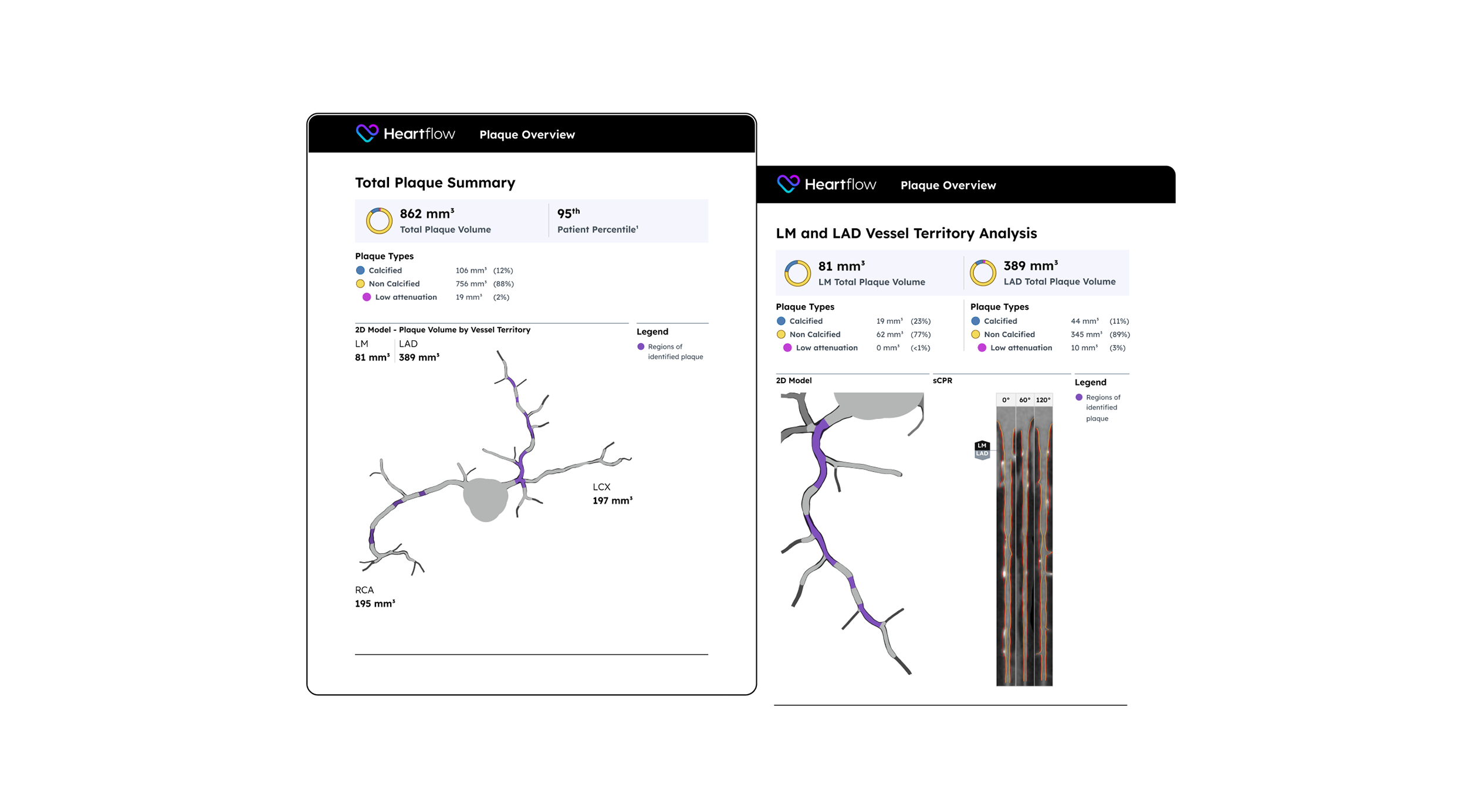 screenshot of downloadable plaque analysis patient reports