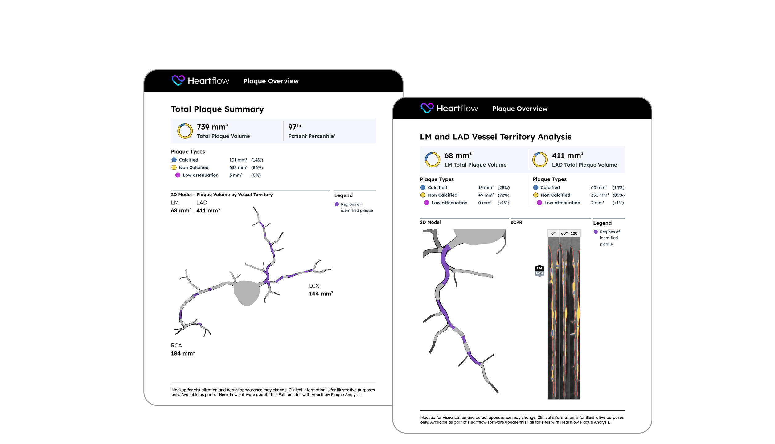 screenshot of downloadable plaque analysis patient reports