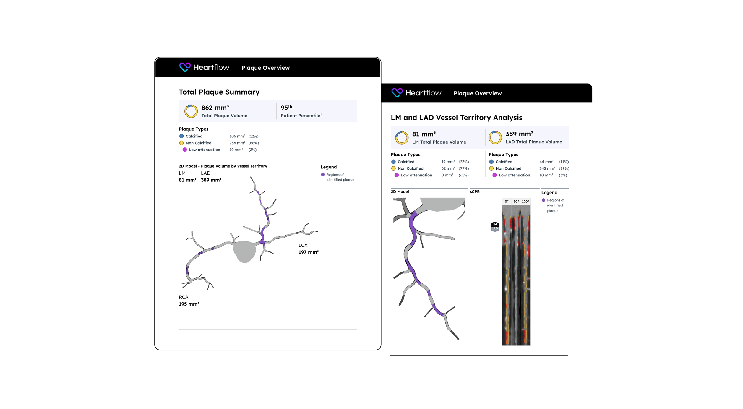 screenshot of downloadable plaque analysis patient reports