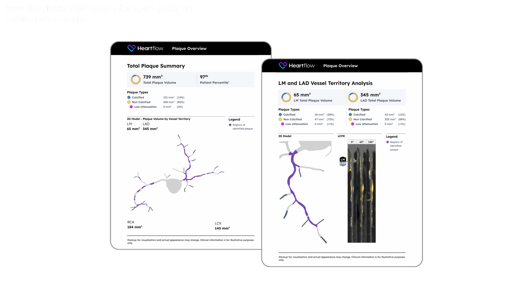 screenshot of downloadable plaque analysis patient reports