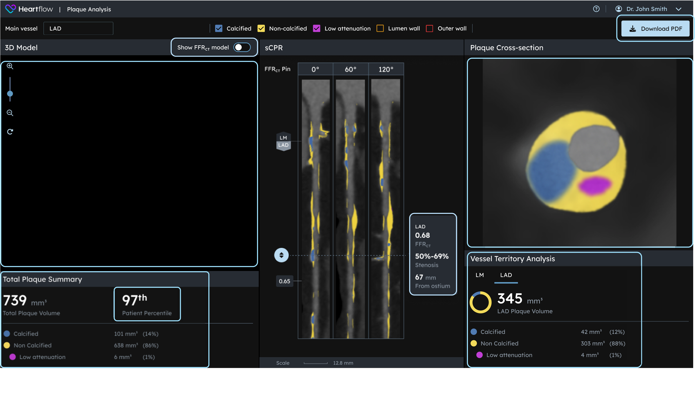 screenshot of plaque analysis