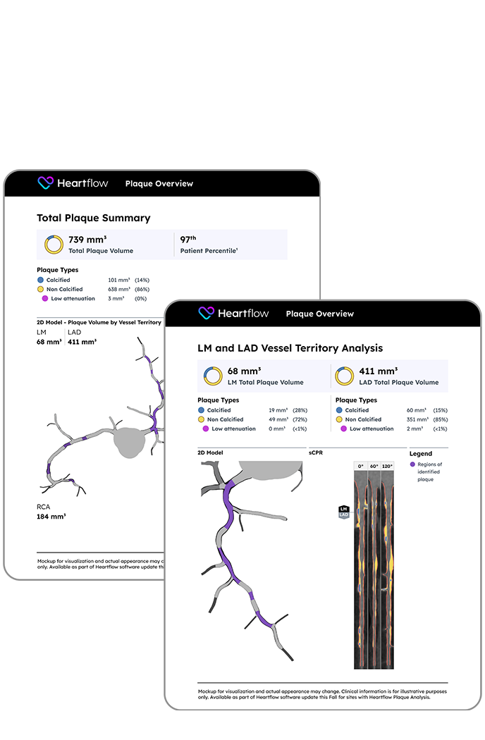 image of the downloadable plaque analysis patient reports