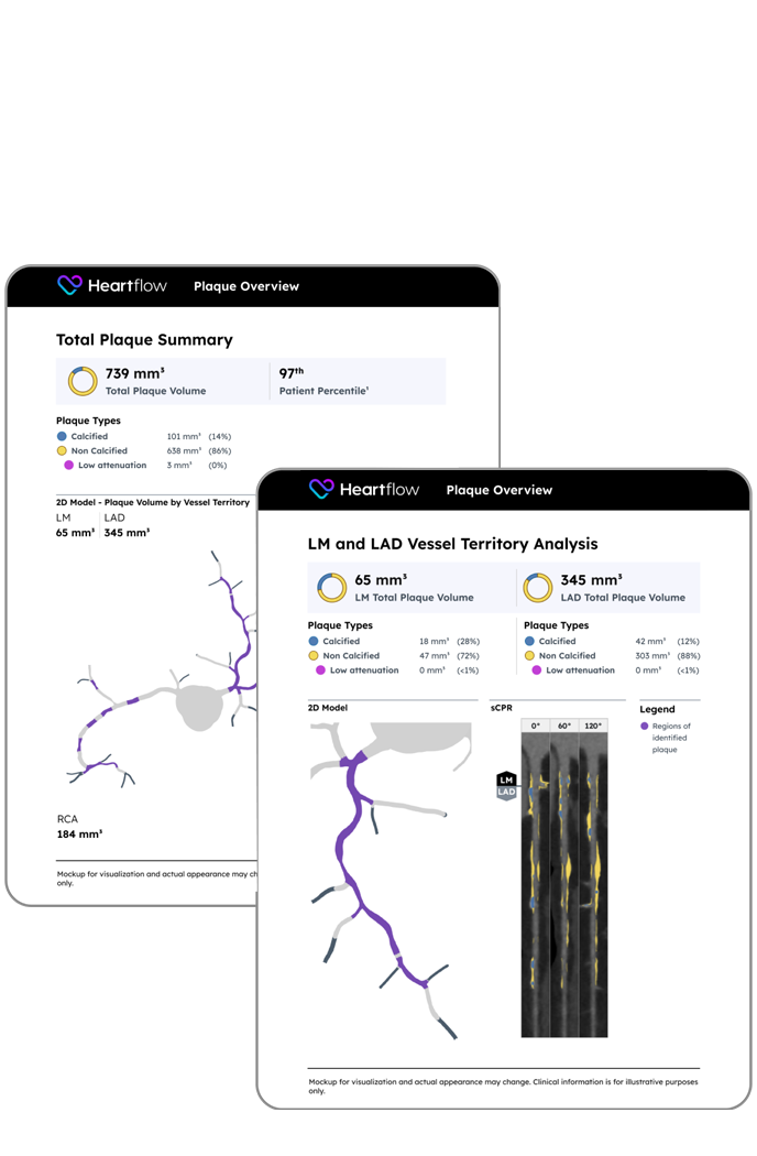 image of the downloadable plaque analysis patient reports