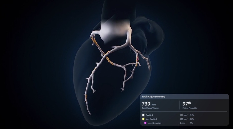 plaqueproductexplainer