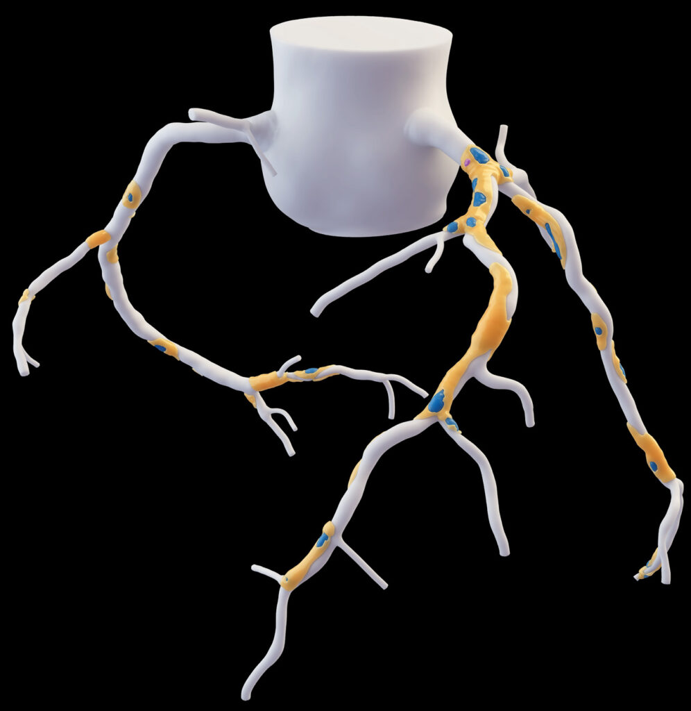 scct deep plaque window cling