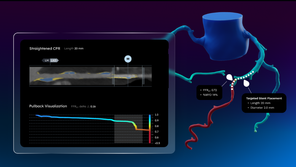 26 0309 hf contenthub graphics drwoodctguidedpci