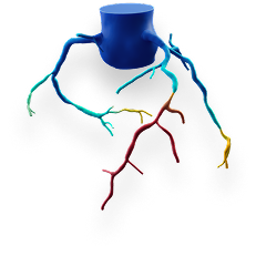 FFRct Analysis 3D Model